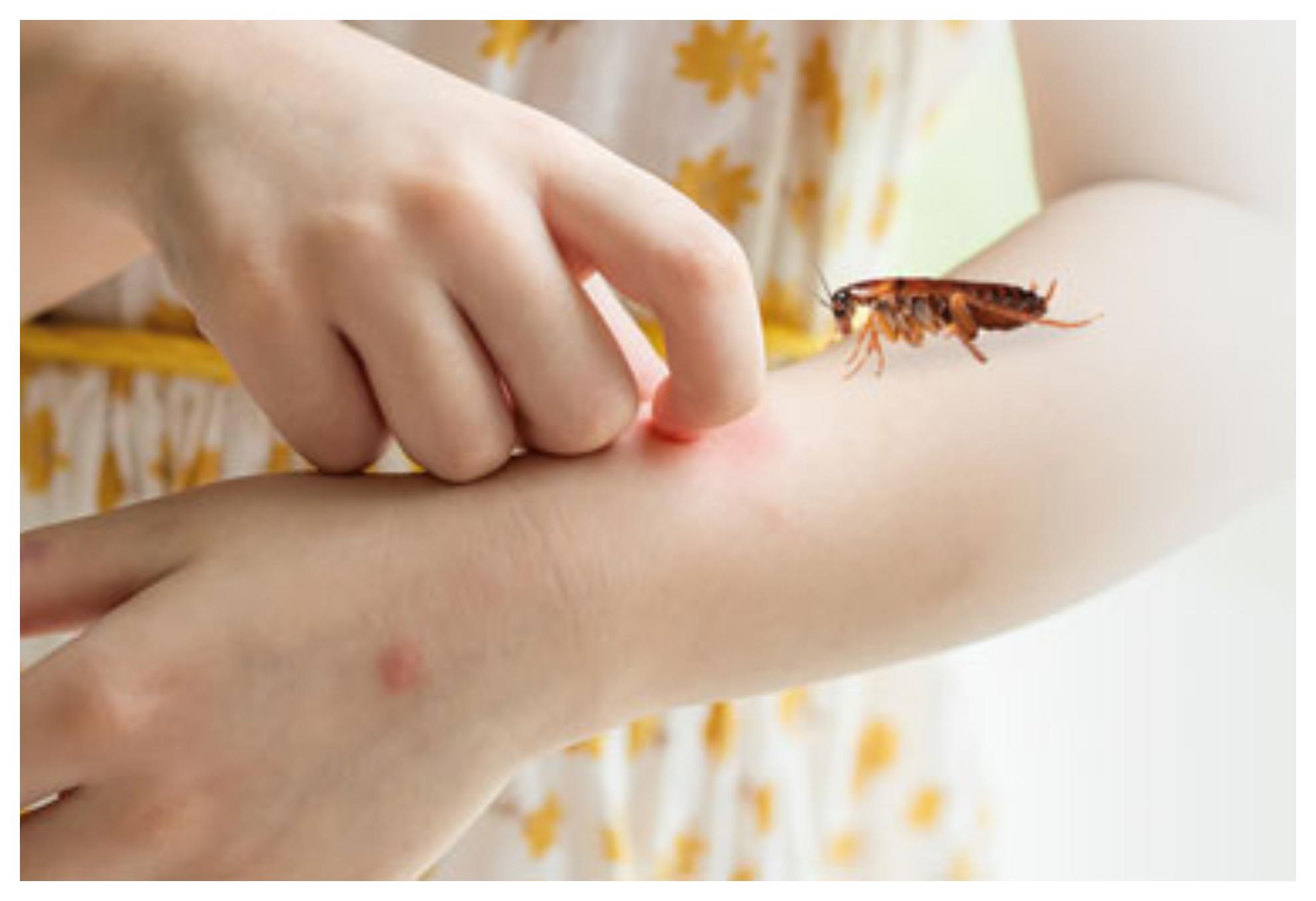 Το τσίμπημα κατσαρίδας μπορεί να αποβεί μοιραίο: Δες φώτο και αναγνώρισέ το