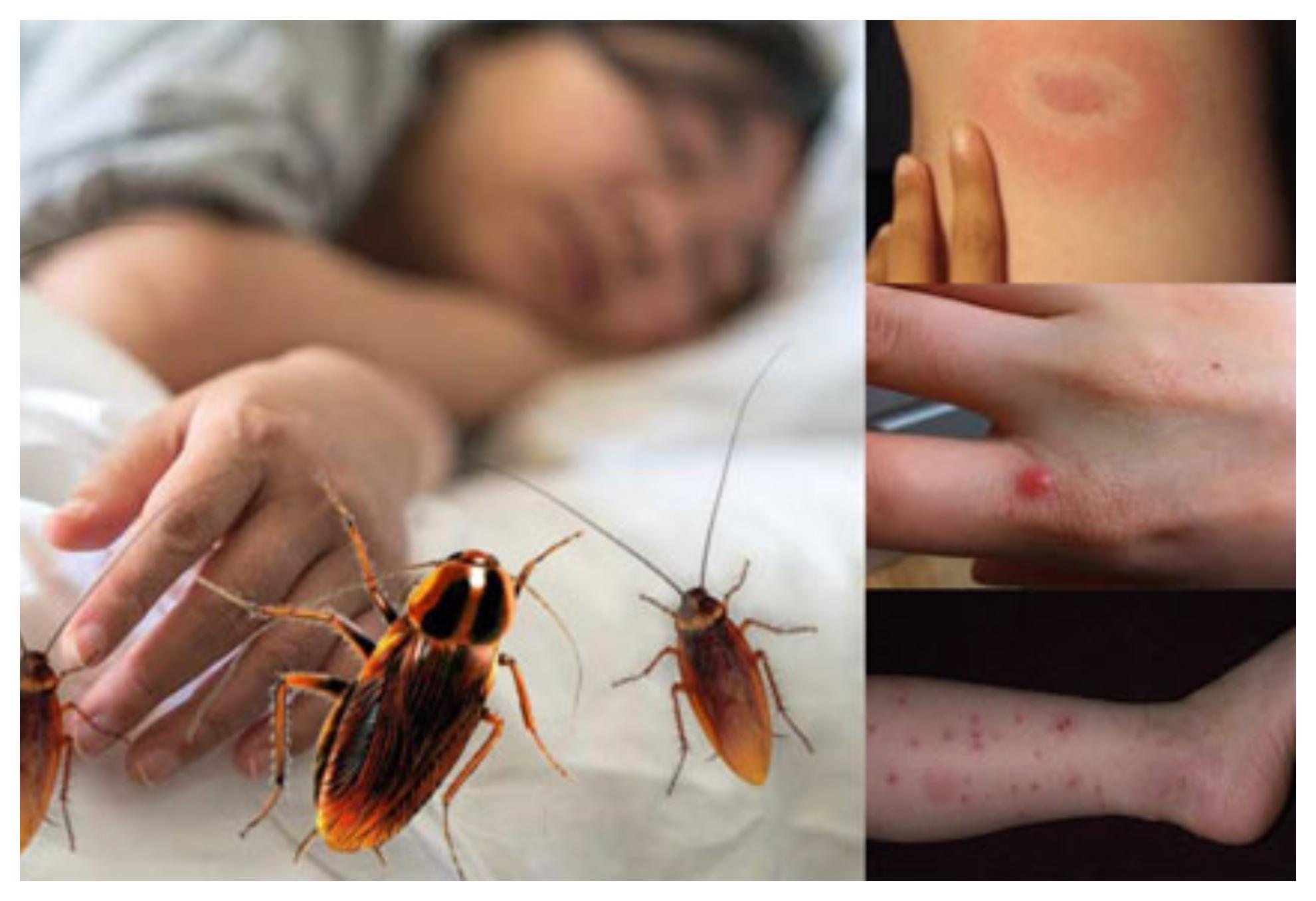 Το τσίμπημα κατσαρίδας μπορεί να αποβεί μοιραίο: Δες φώτο και αναγνώρισέ το