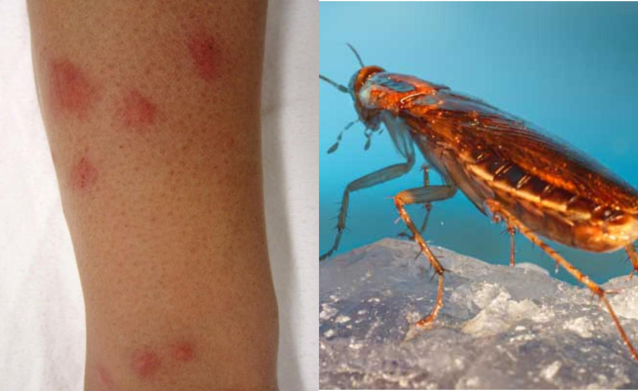 Το τσίμπημα κατσαρίδας μπορεί να αποβεί μοιραίο: Δες φώτο και αναγνώρισέ το