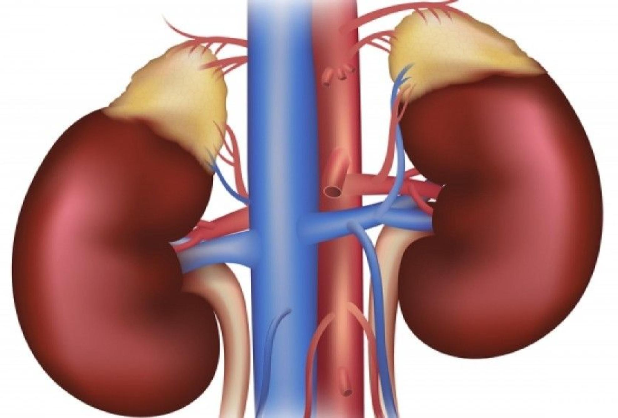 Πέτρες στα νεφρά: Αυξημένες πιθανότητες να σχηματισμού τους το καλοκαίρι είναι – Τι να κάνετε για να το αποφύγετε