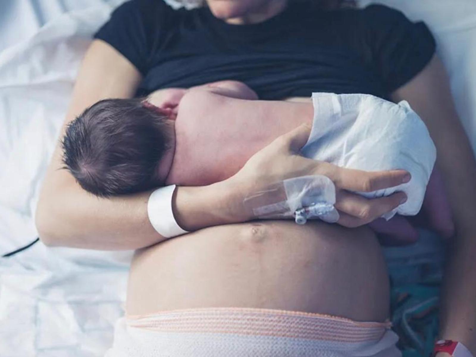 Βρεφικό μικροβίωμα-περισσότερα-πλεονεκτήματα-για-τα-βρέφη-η-καισαρική-