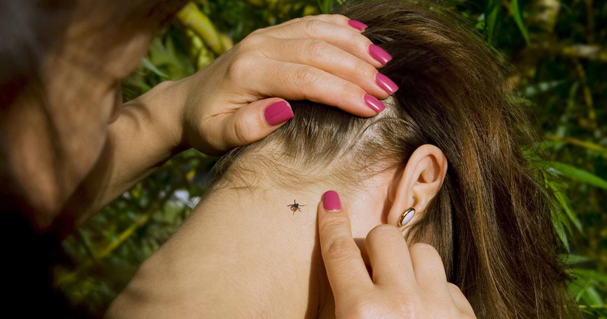 έξυπνο κόλπο-για-να-αφαιρέσουμε-τσιμπούρια- έξυπνο κόλπο-για-να-αφαιρέσουμε-τσιμπούρια-