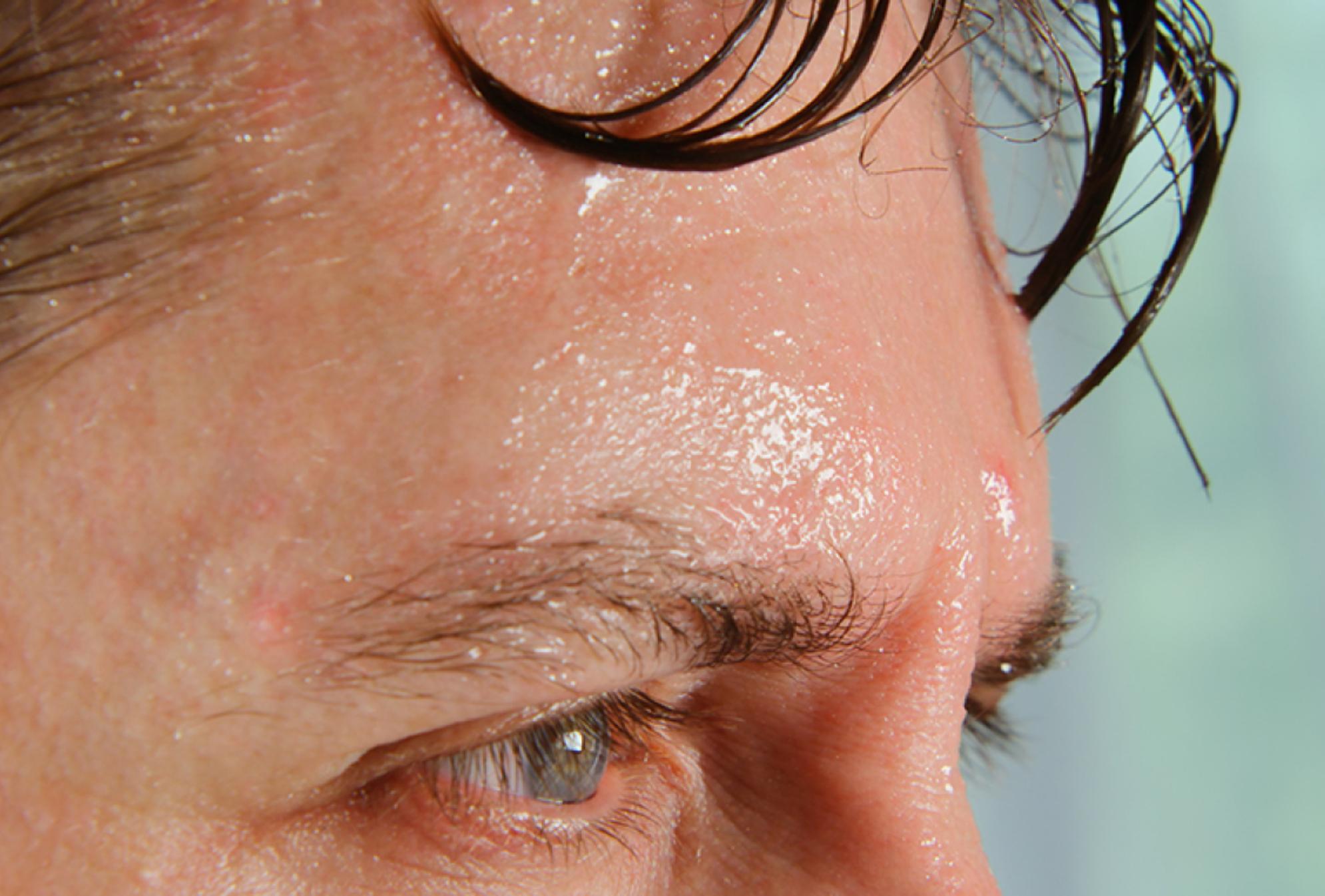 Έντονος ιδρώτας: Δες πώς να σταματήσεις αυτό το δύσκολο πρόβλημα με μερικές απλές λύσεις