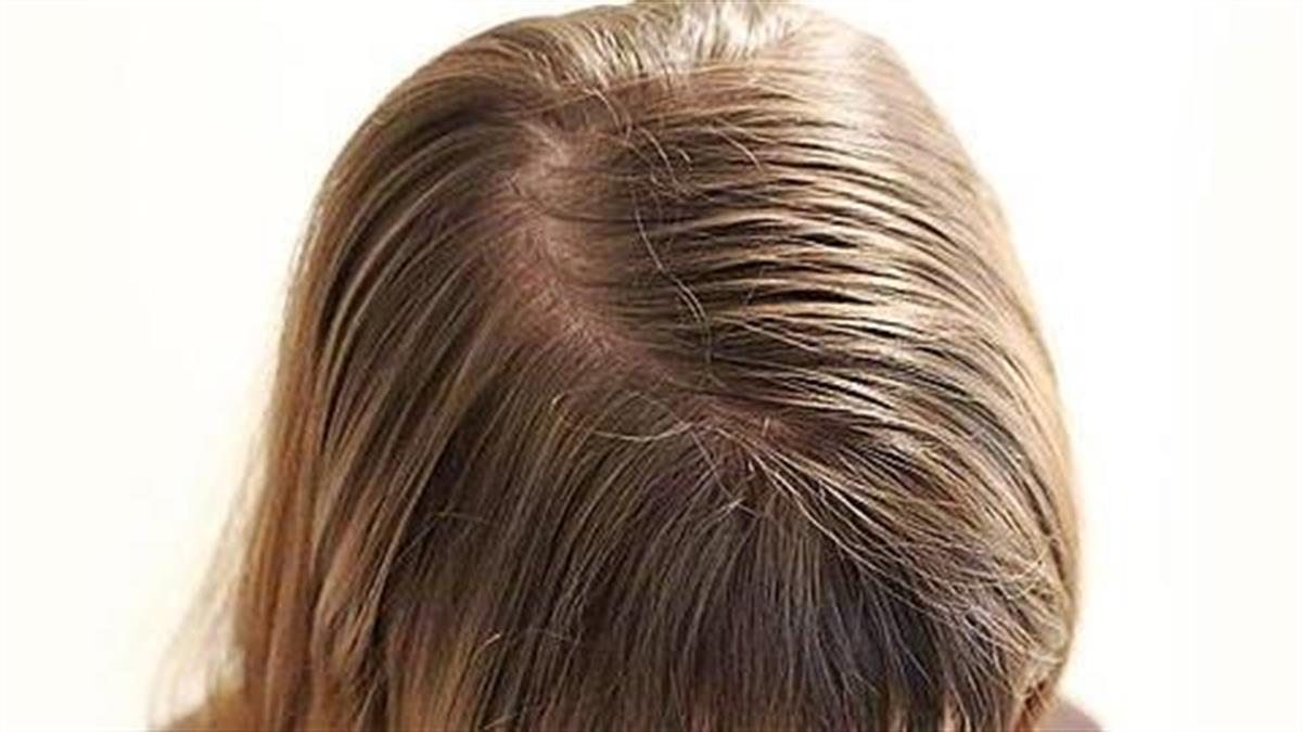 3-λάθη-που-λαδώνουν-τα-μαλλιά-συχνά- 3-λάθη-που-λαδώνουν-τα-μαλλιά-συχνά-