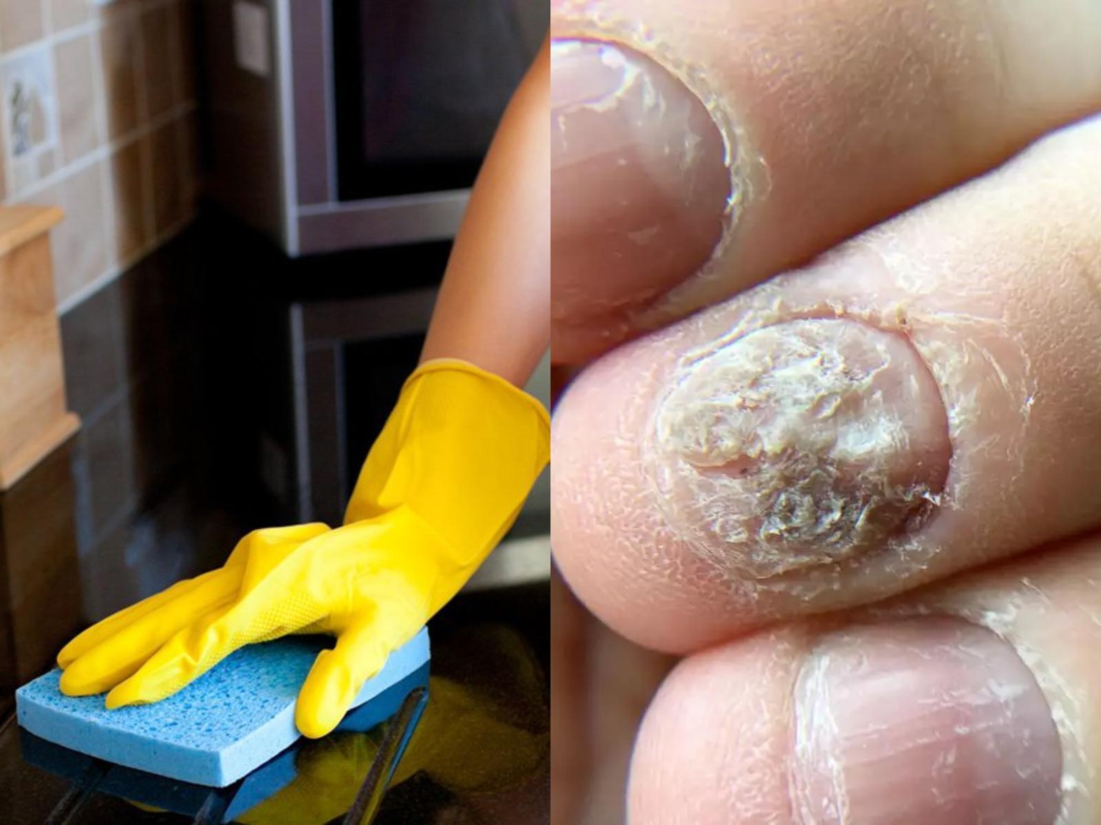 ασθένειες-όταν-καθαρίζετε-χωρίς-γάντια-