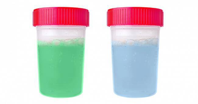 7 πράγματα που λένε τα ούρα για την υγεία σου