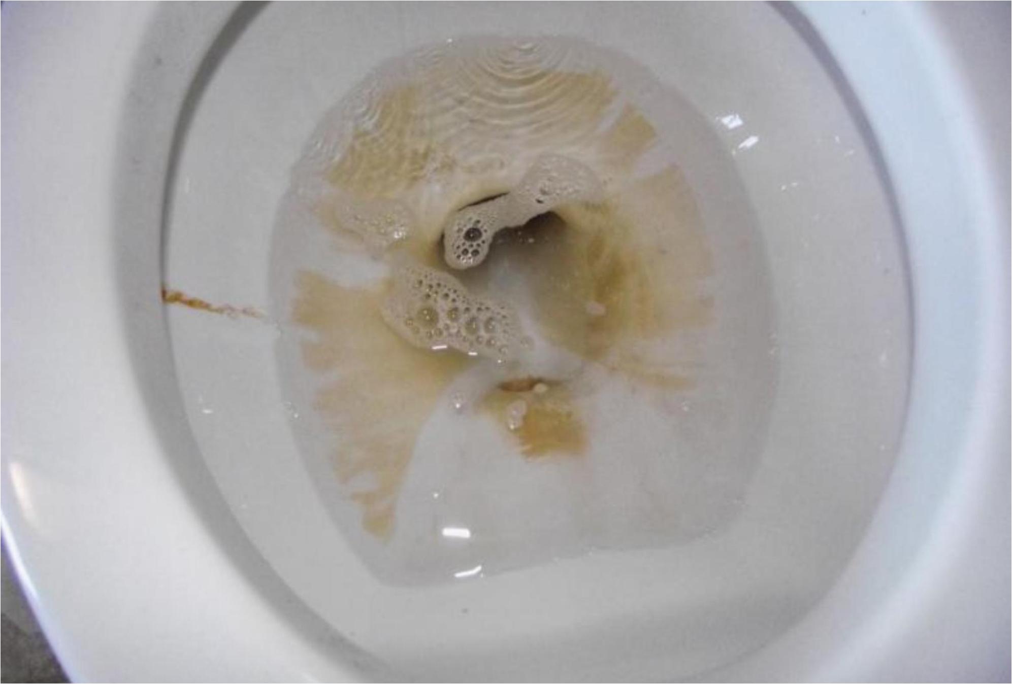 Πουρί και κιτρινίλα στην λεκάνη της τουαλέτας: