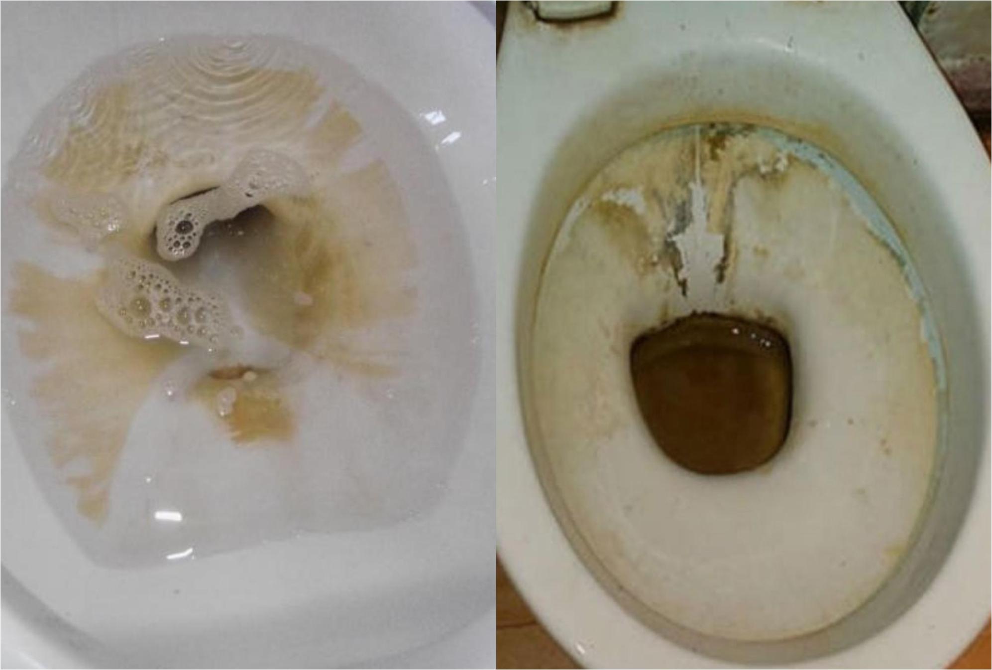 Πουρί και κιτρινίλα στην λεκάνη της τουαλέτας: