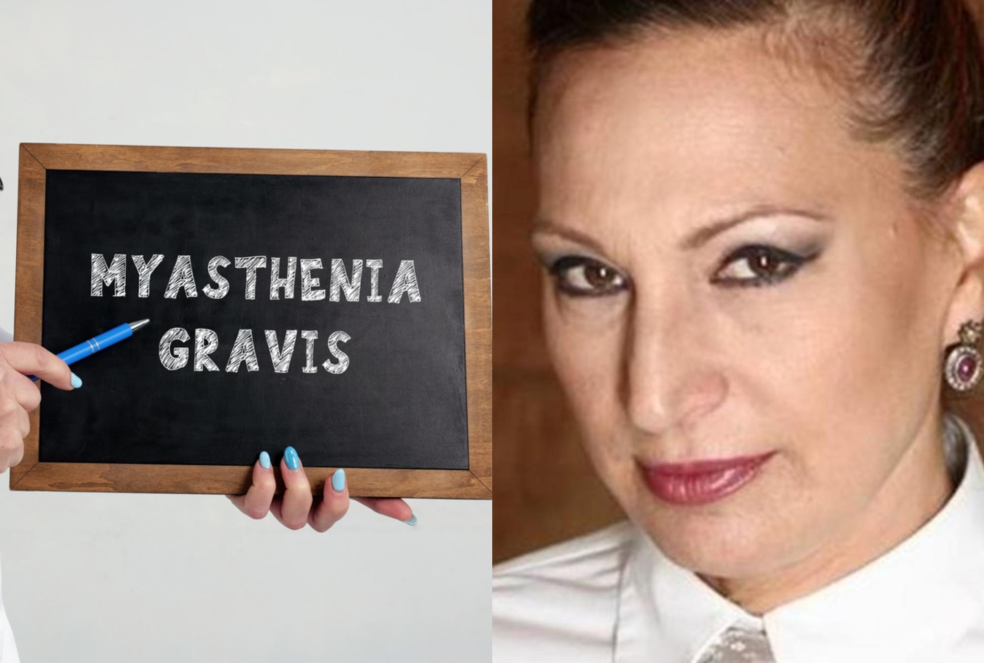Μυασθένεια Gravis: Η Ελένη Τζώρτζη μιλά για το αυτοάνοσο που την ταλαιπωρεί και το έχουν 10 στα 100.000 άτομα