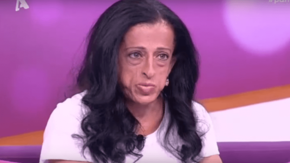 Μαρία Λοΐζου : Η Εμφάνιση της και το bullying – «Έλεγαν στη μητέρα μου να με πετάξει να με φάνε τα σκυλιά»