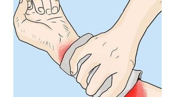 σοβαρή-μορφή-εγκαύματος-αντιμετώπιση- σοβαρή-μορφή-εγκαύματος-αντιμετώπιση-