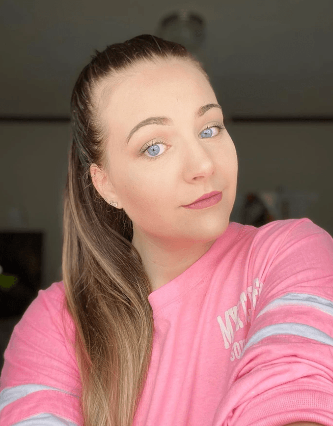 είχε-σύνδρομο down-και-το-έμαθε-στα-20-της-χρόνια-άγνωστα συμπτώματα-