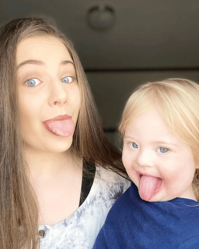 είχε-σύνδρομο down-και-το-έμαθε-στα-20-της-χρόνια-άγνωστα συμπτώματα-