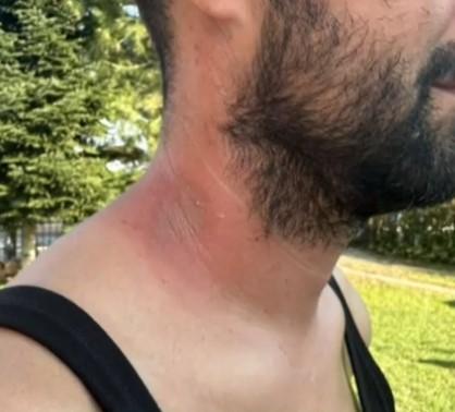 Κακοκαιρία Daniel: Το πρώτο κρούσμα μόλυνσης από τα νερά βρέθηκε στην Καρδίτσα