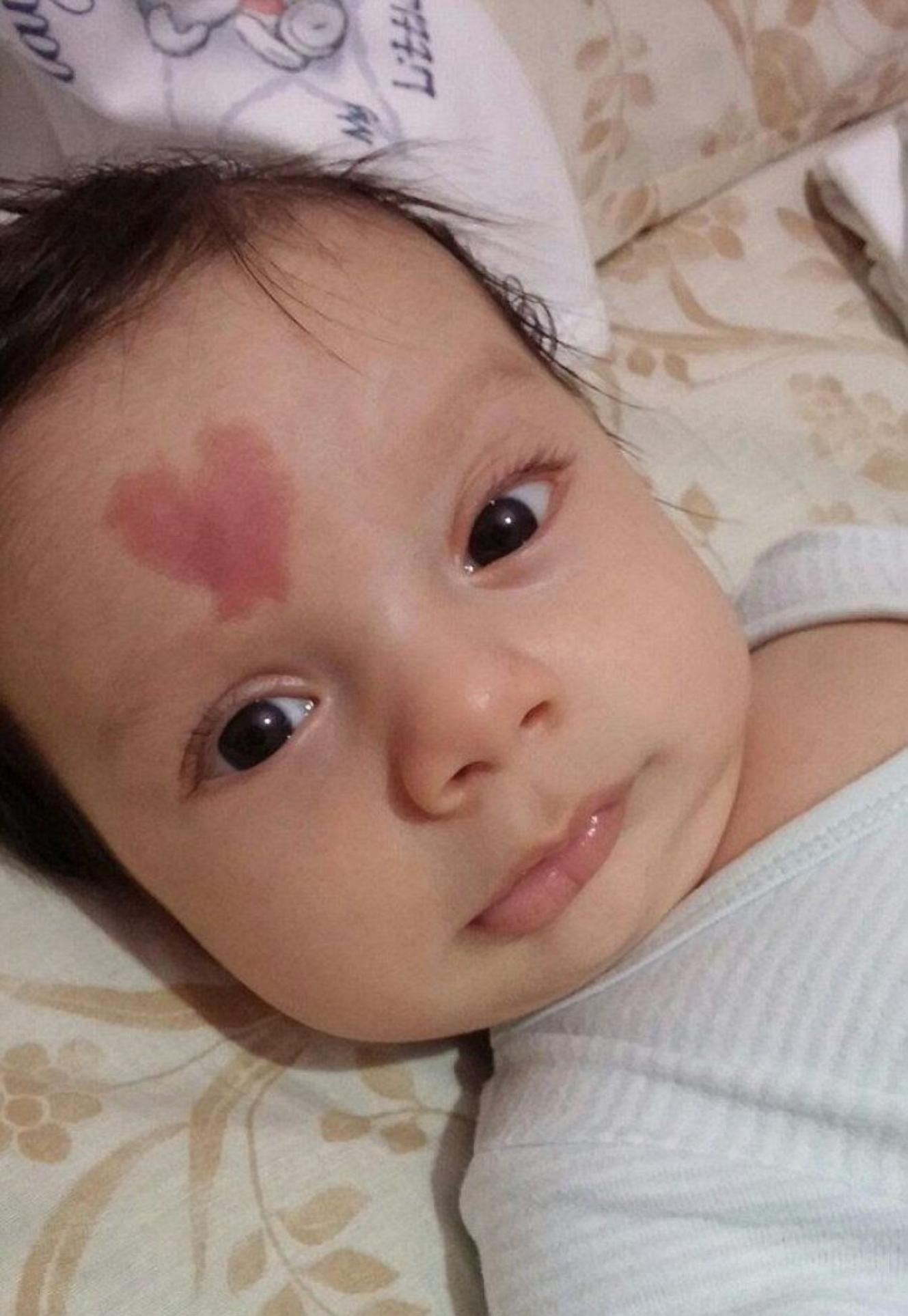 Το μωράκι της αγάπης: Γεννήθηκε με ένα σημάδι σε σχήμα καρδιάς και κάνει τους πάντες να λιώνουν μόλις το βλέπουν