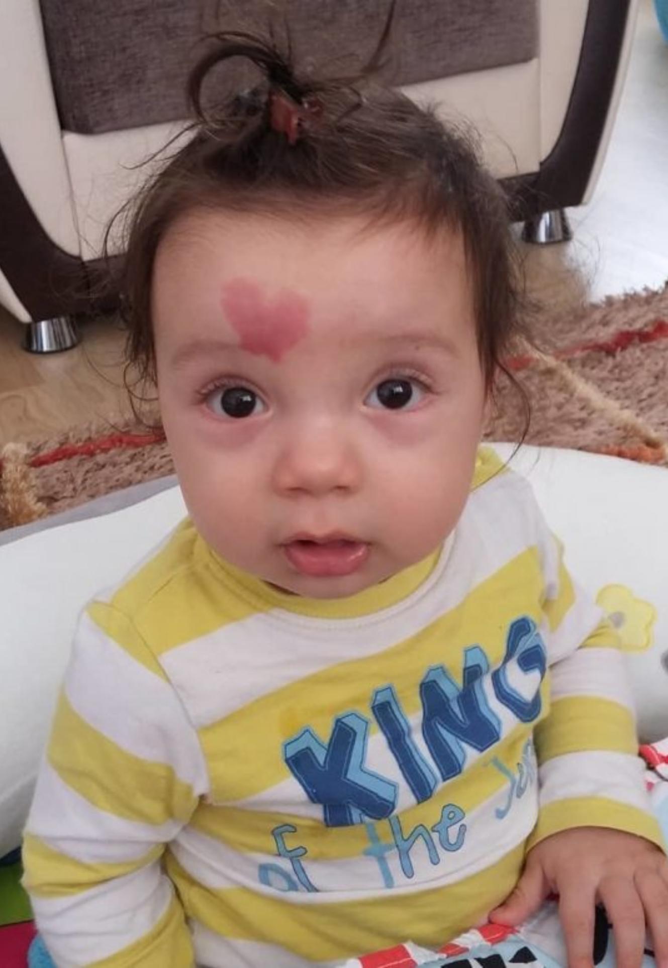 Το μωράκι της αγάπης: Γεννήθηκε με ένα σημάδι σε σχήμα καρδιάς και κάνει τους πάντες να λιώνουν μόλις το βλέπουν