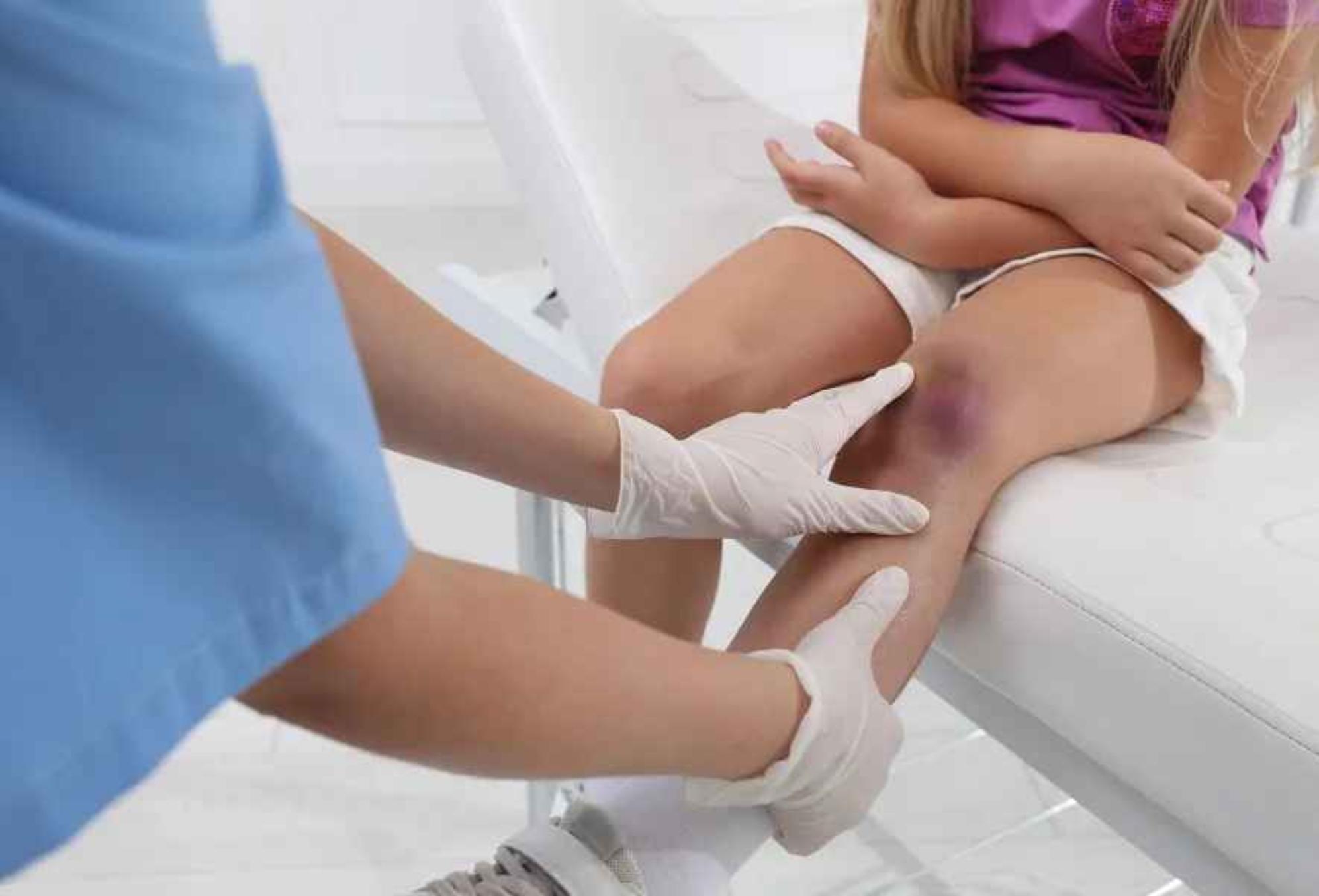 Back to school: Σχολικά ατυχήματα πότε είναι πιο πιθανό να συμβούν και πώς θα τα αποφύγουμε