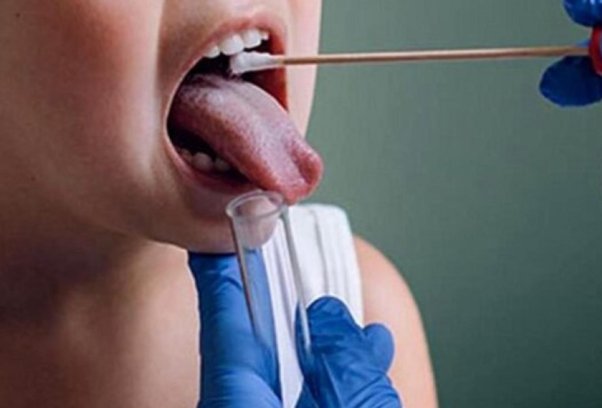 Στρεπτόκοκκος Α στα παιδιά: Ποια είναι τα συμπτώματα ο τρόπος μετάδοσης και πότε πρέπει να πάμε στον γιατρό