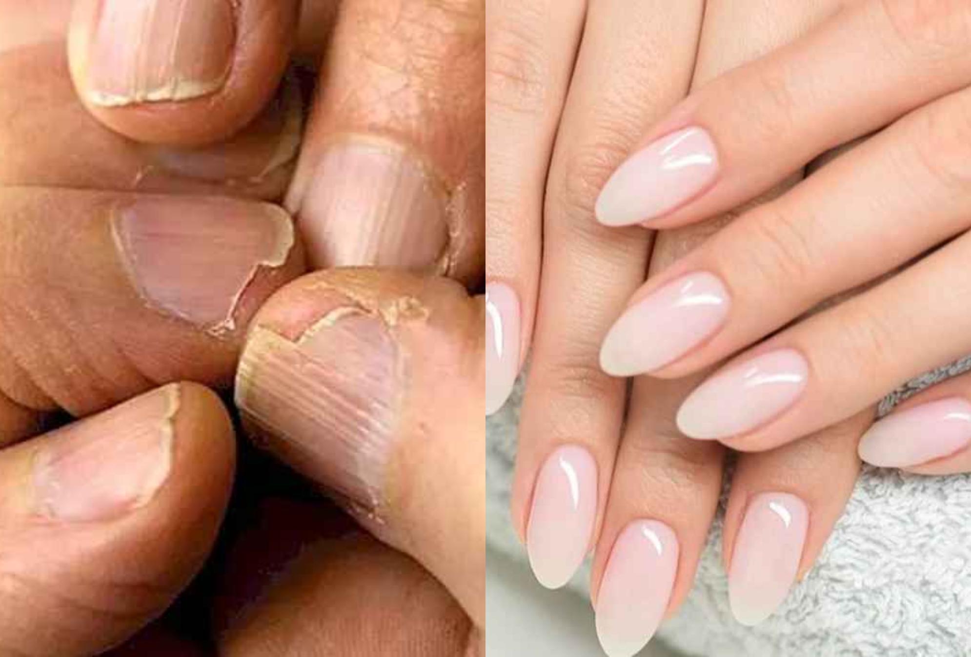 Φθινόπωρο 2023 Νύχια: 7 tips για δυνατά μακριά και υγιή νύχια