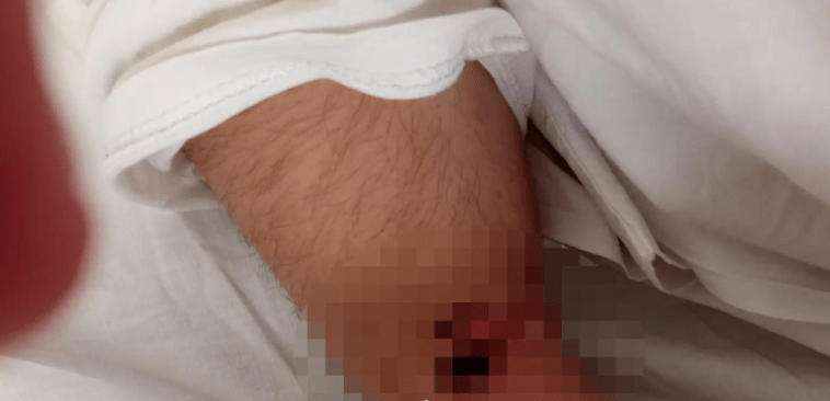 Πατέρας καταγγέλλει ιδιωτικό θεραπευτήριο για τον βασανισμό του ΑμεΑ παιδιού του – «Ήταν ετοιμοθάνατο σε ένα φορείο»