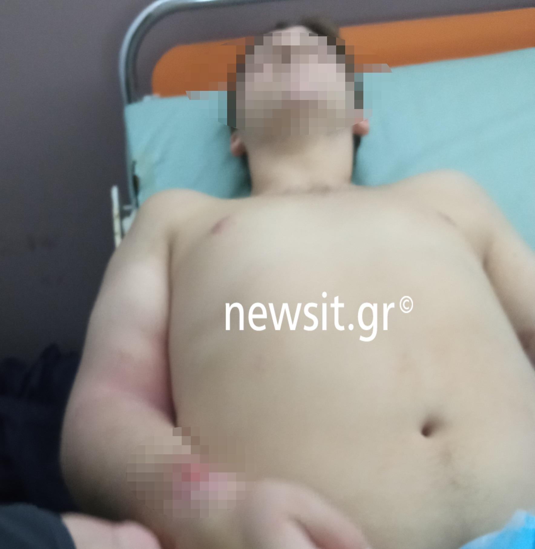 Πατέρας καταγγέλλει ιδιωτικό θεραπευτήριο για τον βασανισμό του ΑμεΑ παιδιού του – «Ήταν ετοιμοθάνατο σε ένα φορείο»