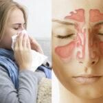 Μπούκωμα καταρροή και βουλωμένη μύτη: Δείτε να το αντιμετωπίσετε γρήγορα φυσικά και να αναπνεύσετε πάλι ελεύθερα