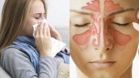 Μπούκωμα καταρροή και βουλωμένη μύτη: Δείτε να το αντιμετωπίσετε γρήγορα φυσικά και να αναπνεύσετε πάλι ελεύθερα