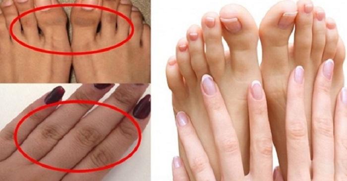 φυσικό-scrub-για-διχρωμία-στα-δάχτυλα- φυσικό-scrub-για-διχρωμία-στα-δάχτυλα-