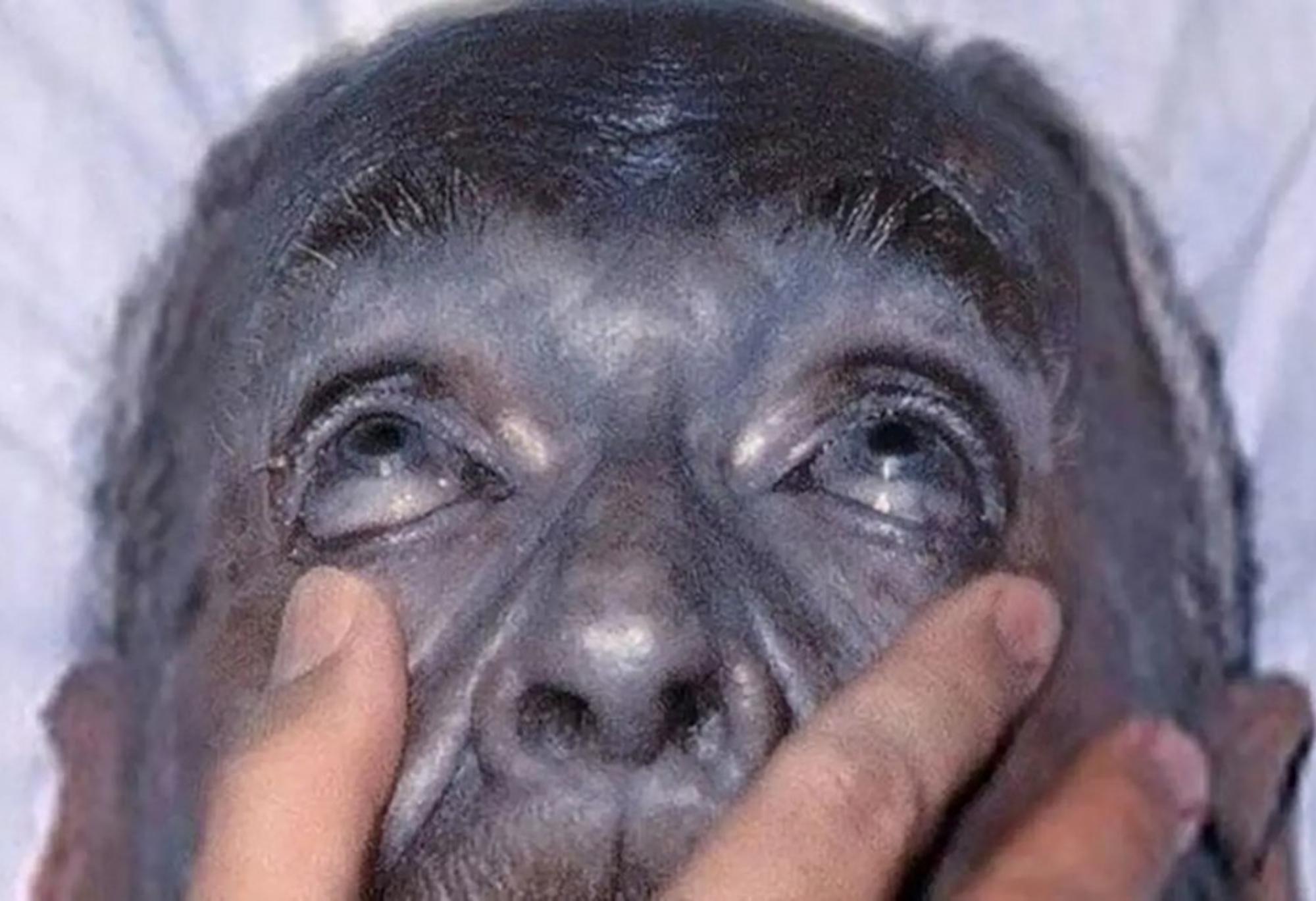 Το πραγματικό Avatar: Η αληθινή ιστορία των Μπλε Ανθρώπων