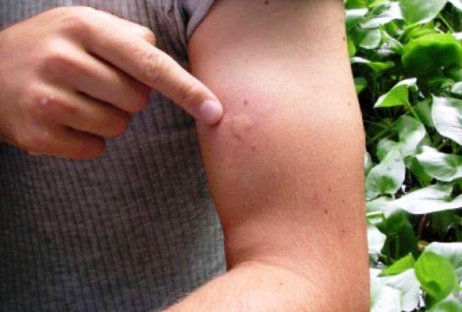 Ανατριχιαστικές Σαρανταποδαρούσες στο σπίτι: Πως να τις εξολοθρεύσετε με απλό τρόπο