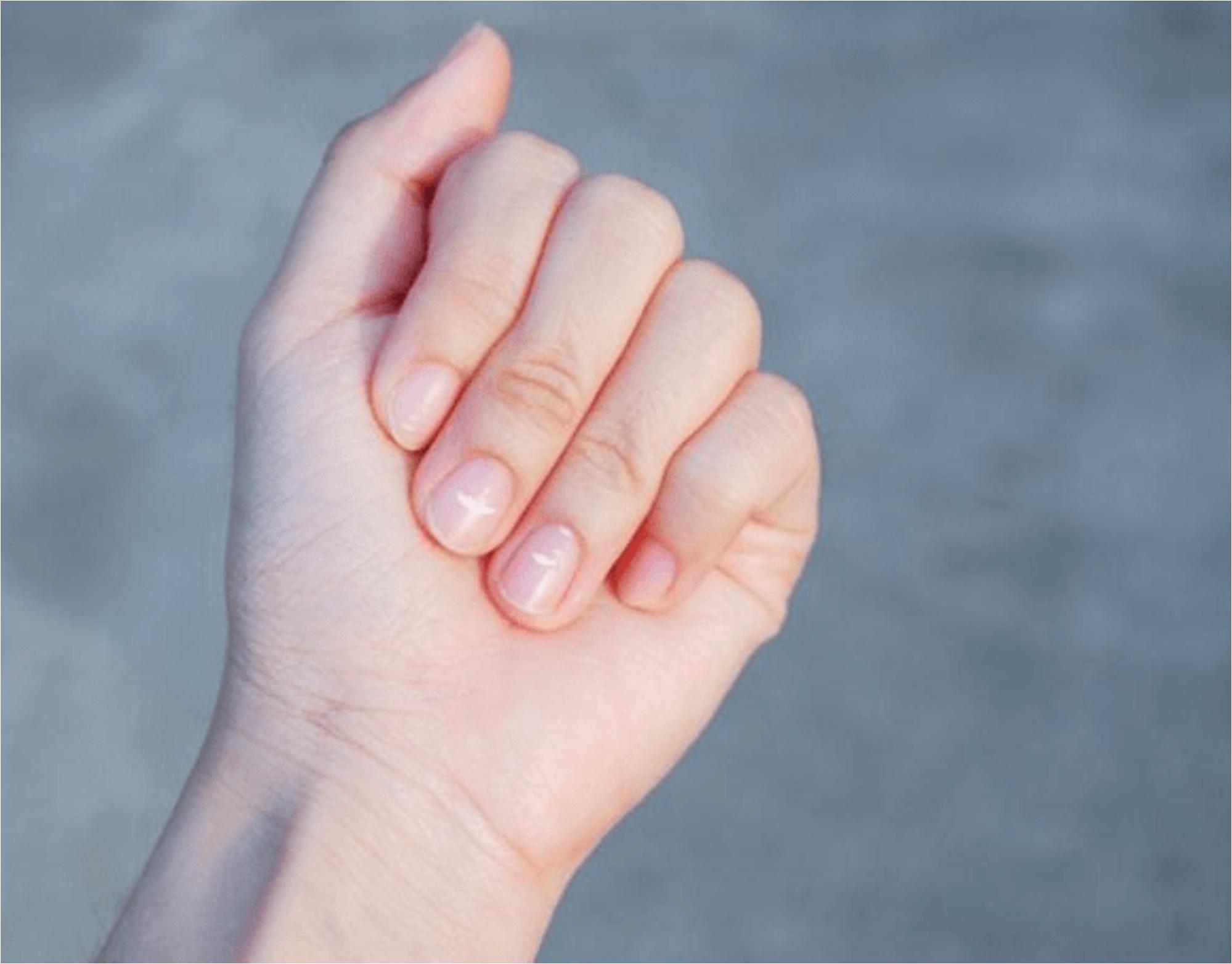 Ανεπάρκεια ασβεστίου: Οι αιτίες τα συμπτώματα και ποιες είναι οι τροφές που βοηθούν την απορρόφηση του