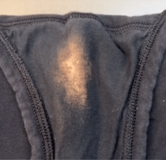 γιατί-ξεθωριάζουν-τα-γυναικεία-εσώρουχα-και-τι-σημαίνει-για-την-υγεία- γιατί-ξεθωριάζουν-τα-γυναικεία-εσώρουχα-και-τι-σημαίνει-για-την-υγεία-