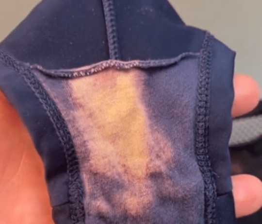 γιατί-ξεθωριάζουν-τα-γυναικεία-εσώρουχα-και-τι-σημαίνει-για-την-υγεία- γιατί-ξεθωριάζουν-τα-γυναικεία-εσώρουχα-και-τι-σημαίνει-για-την-υγεία-