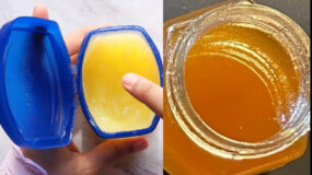 Σπιτική μάσκα με βαζελίνη και μέλι για φυσικό μπότοξ στο σπίτι