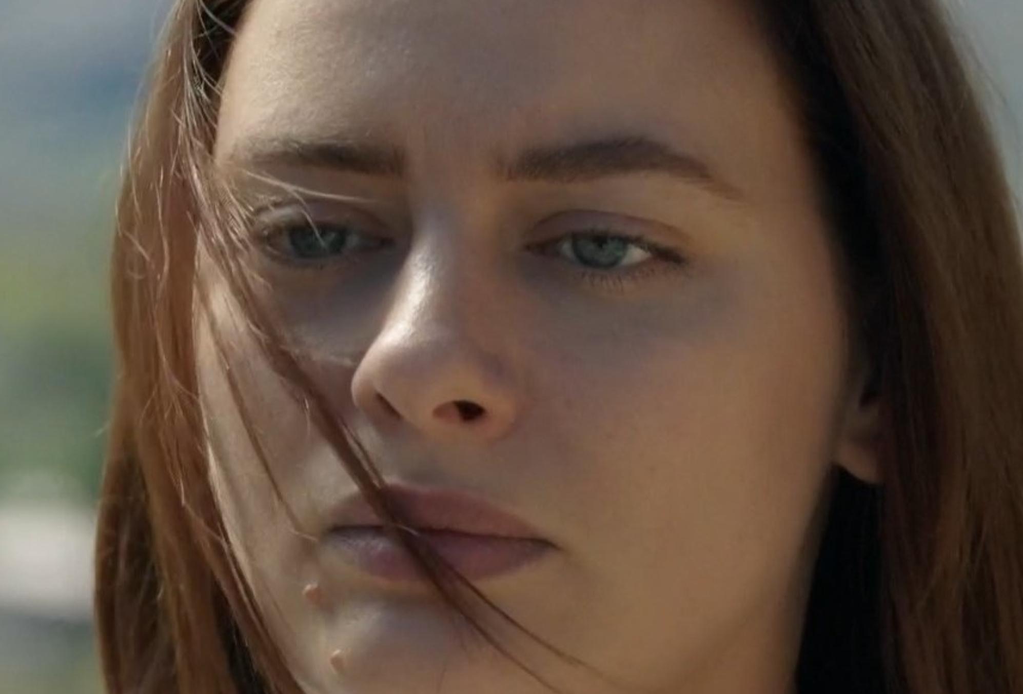 Μετά τη φωτιά: ο Άρης δημιουργεί έναν ασφυκτικό κλοιό γύρω της