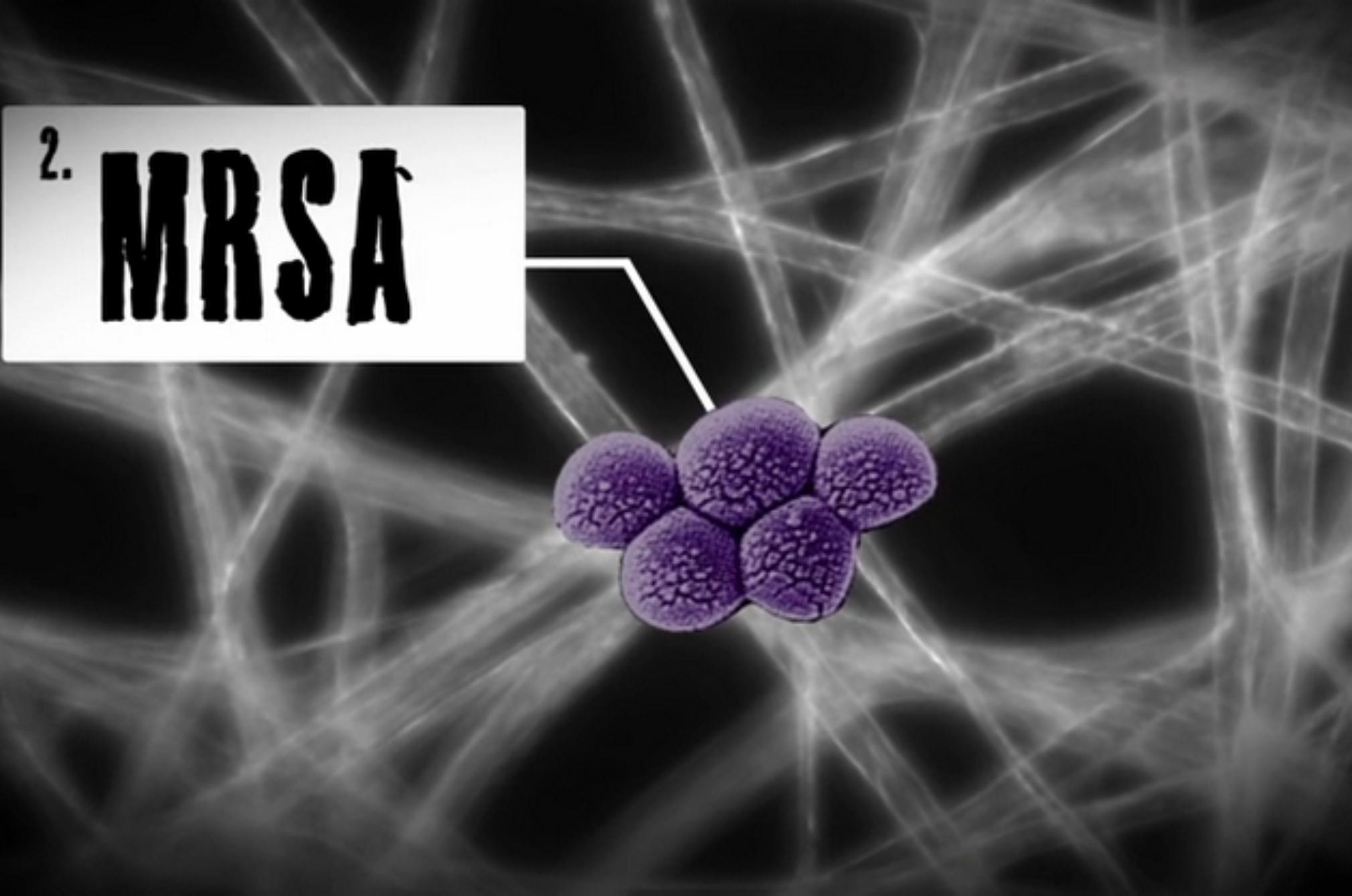 Εκτός από τα ακάρεα αυτά είναι τα επικίνδυνα έντομα και όχι μόνο που κρύβονται στο στρώμα σου: Τσιμπάν δηλητηριάζουν και απειλούν την υγεία σου