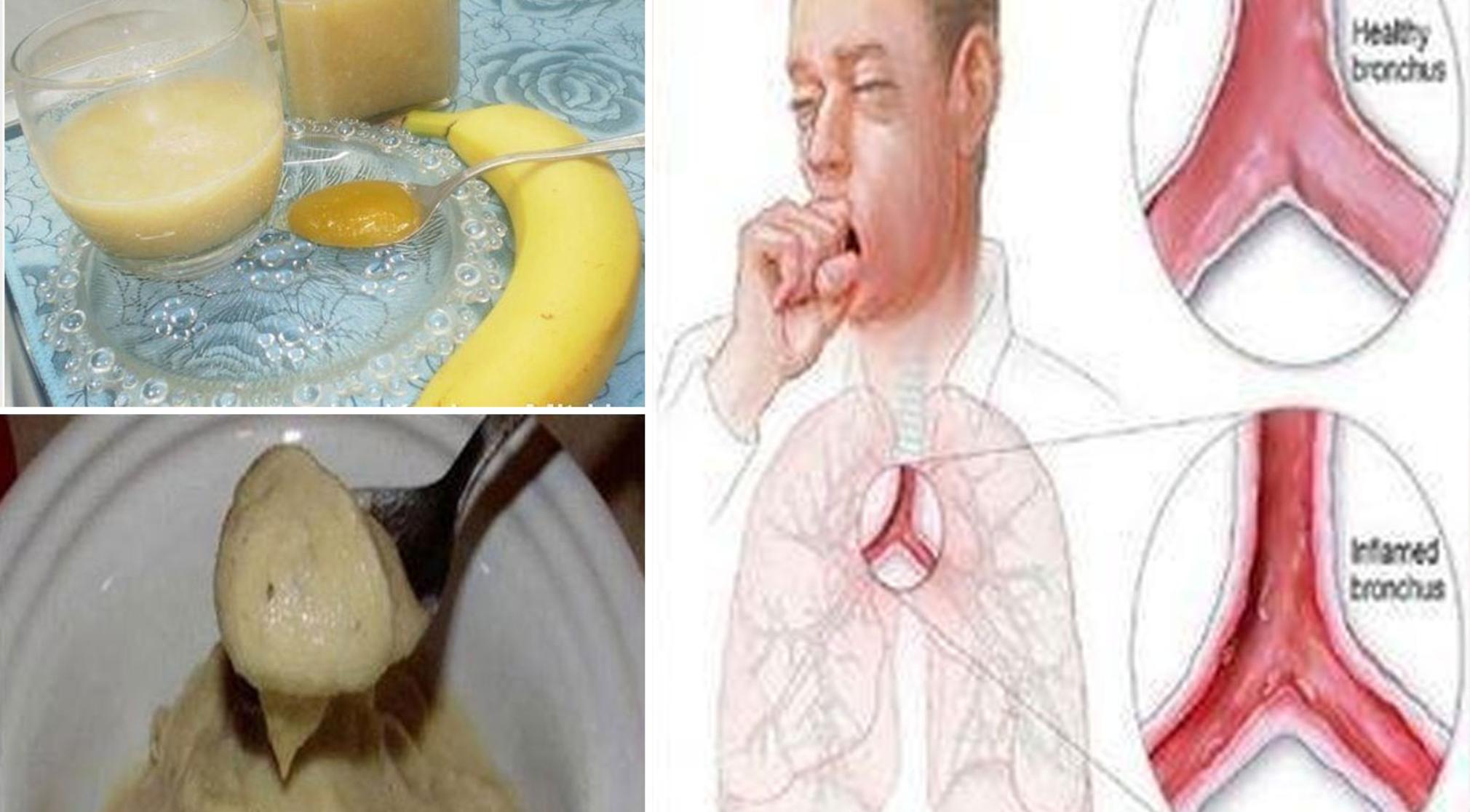 Σπιτικό σιρόπι: Το απόλυτο ρόφημα για ανακούφιση από τον πονόλαιμο τον έντονο βήχα και το στομάχι – Έτοιμο σε μόλις 5 Λεπτά