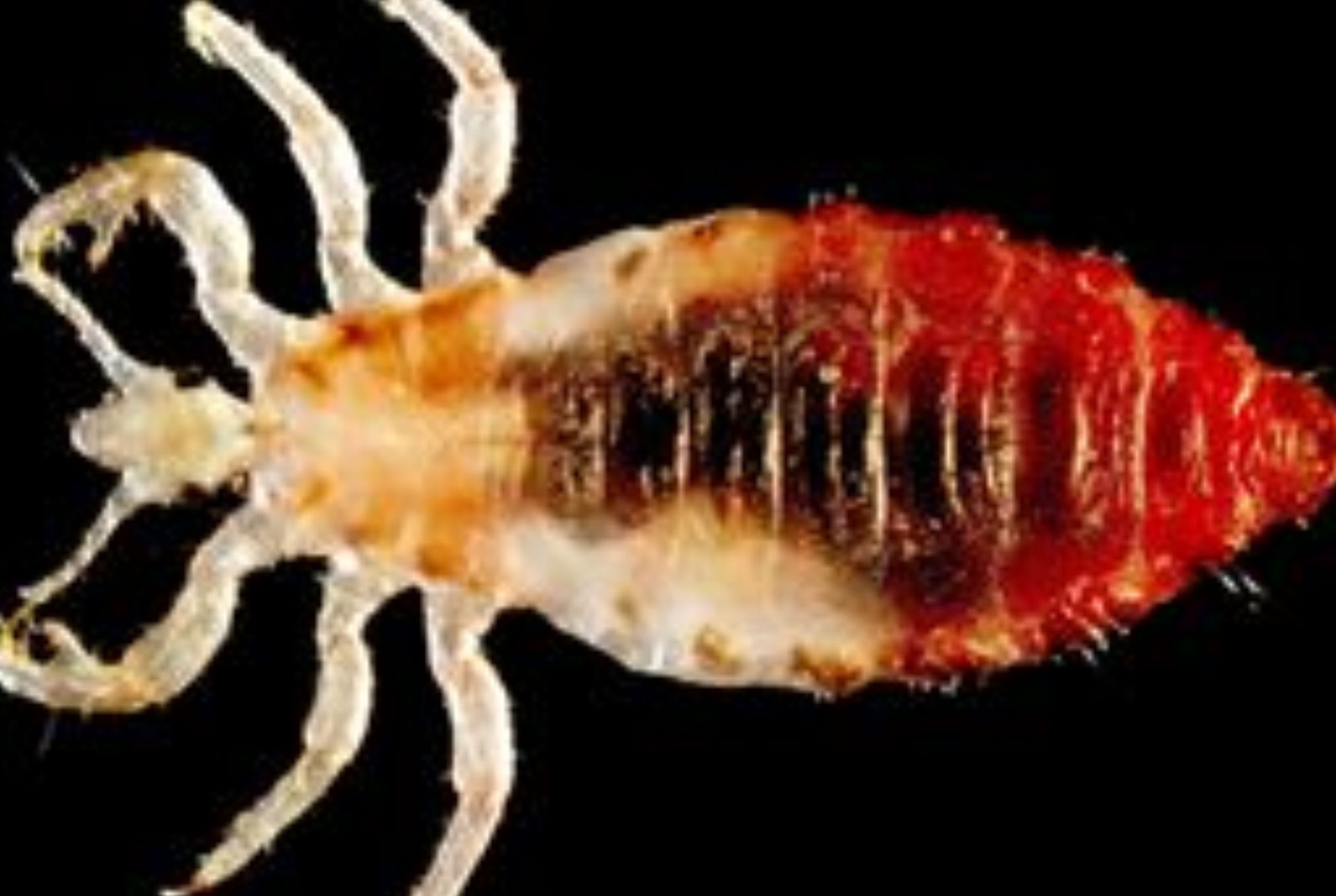 Ψείρες σώματος: Πόσο επικίνδυνες είναι τι επιπλοκές έχει το τσίμπημά τους και πως να απαλλαγείτε μια και καλή