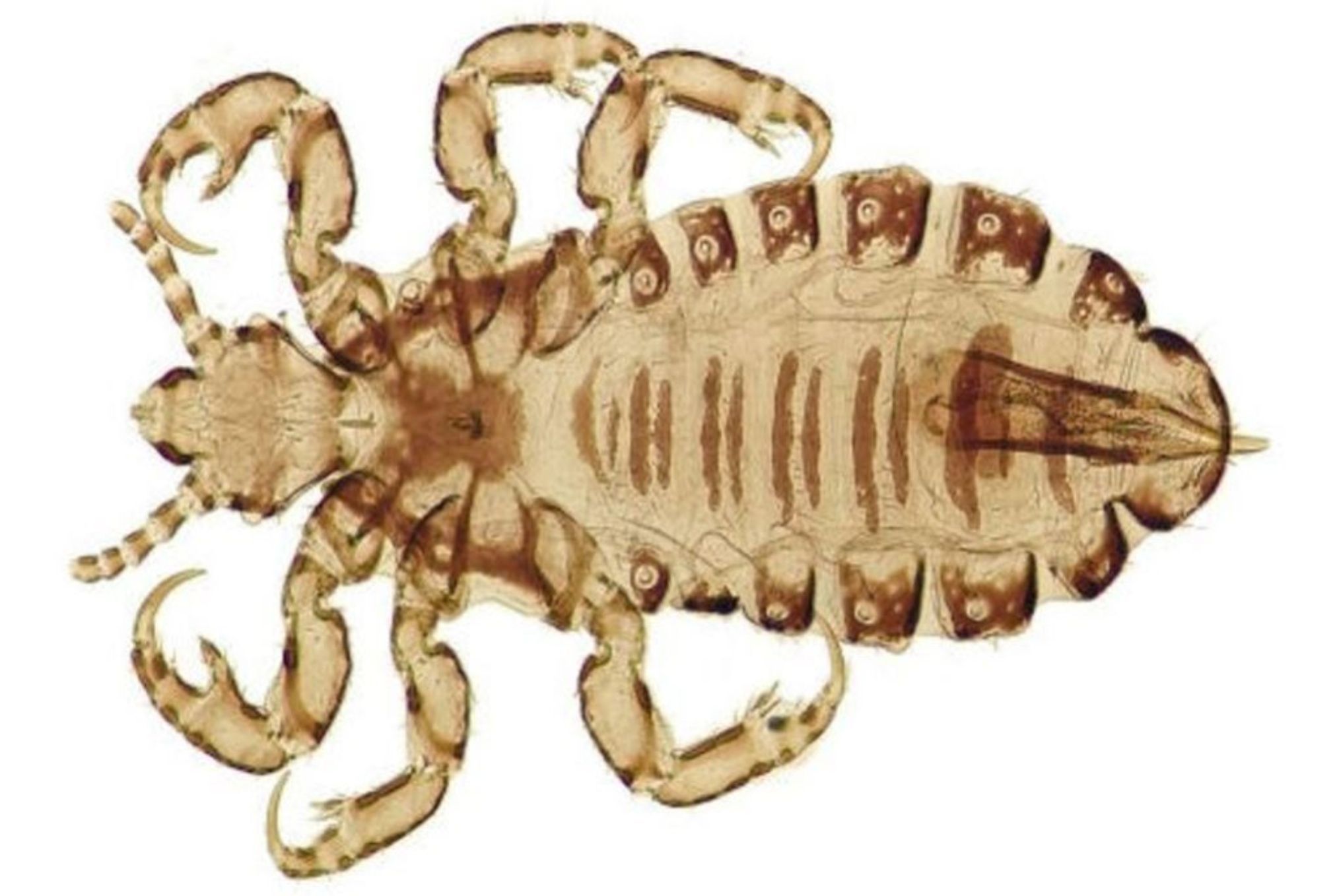 Ψείρες σώματος: Πόσο επικίνδυνες είναι τι επιπλοκές έχει το τσίμπημά τους και πως να απαλλαγείτε μια και καλή