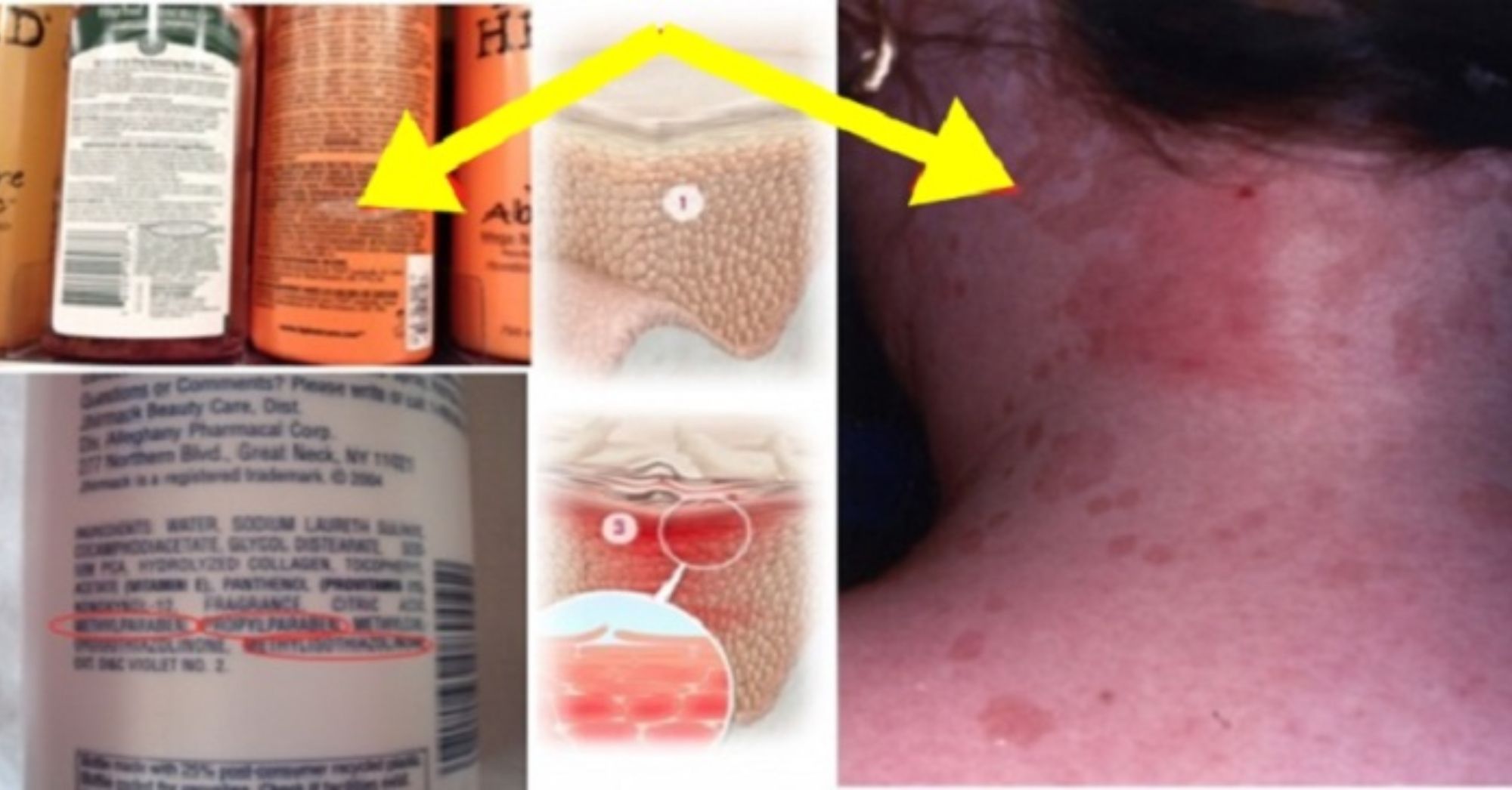 6 Τοξικά συστατικά που περιέχουν τα σαμπουάν: Ποια είναι αυτά και τι μπορούν να προκαλέσουν στην υγεία μας