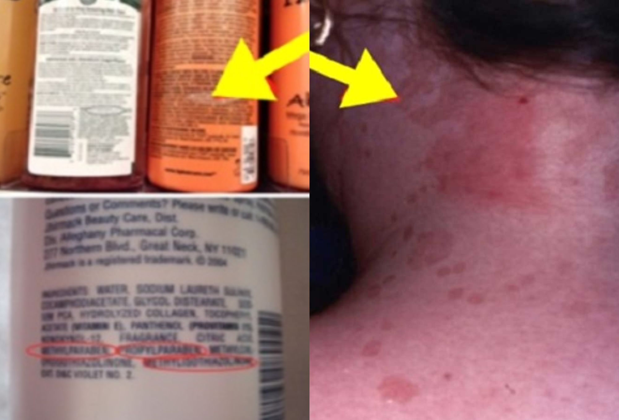 6 Τοξικά συστατικά που περιέχουν τα σαμπουάν: Ποια είναι αυτά και τι μπορούν να προκαλέσουν στην υγεία μας 