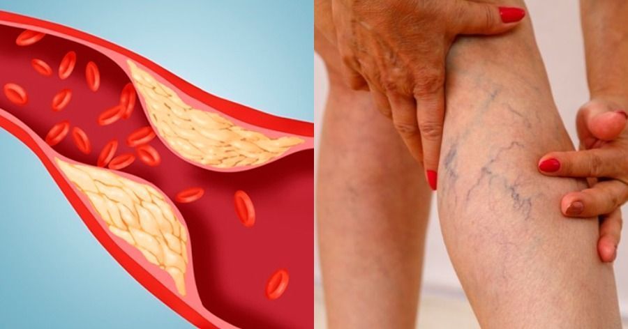 προβλήματα-υγείας-που-προκαλούνται-από-στενά παντελόνια-