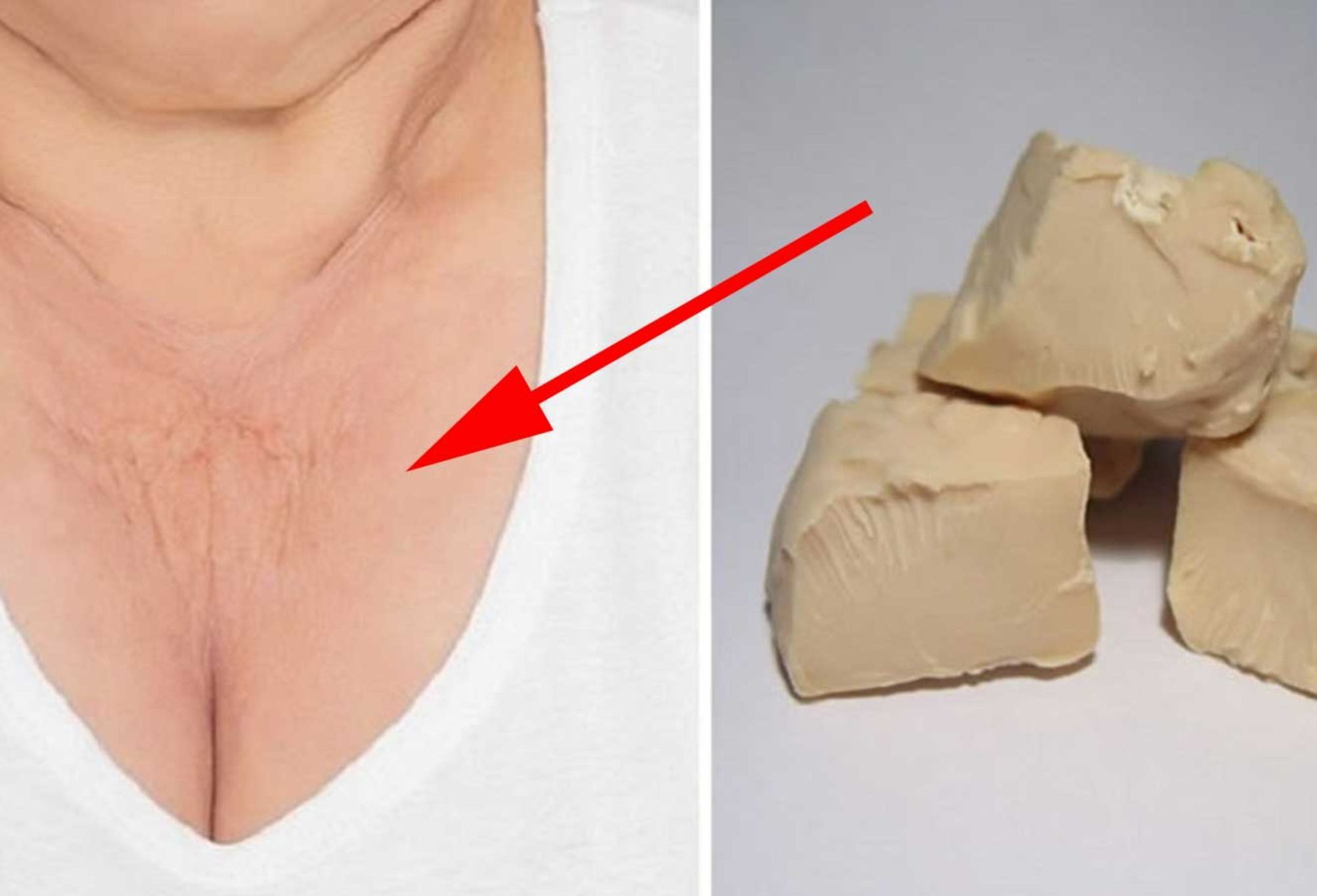 Βαθιές και αντιαισθητικές ρυτίδες στον λαιμό και το ντεκολτέ: Εξαφανίστε τες με Μαγιά Μπύρας