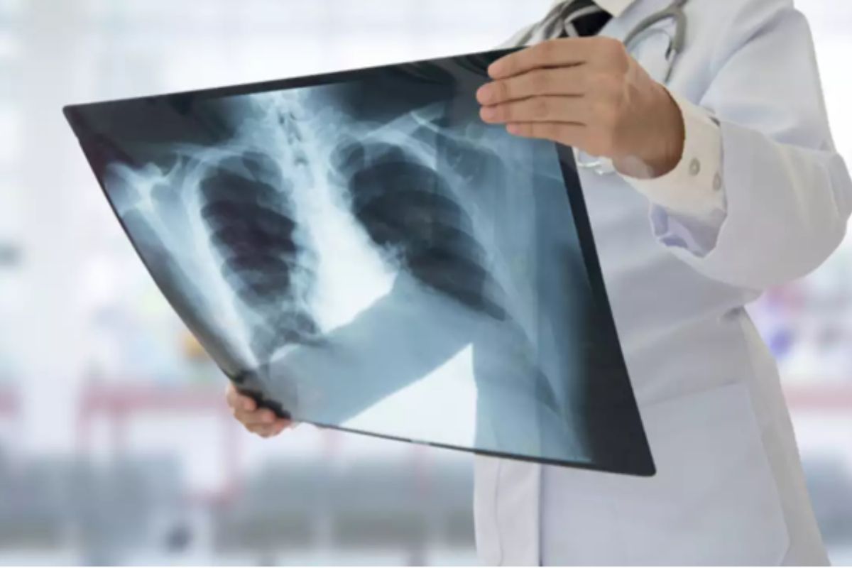 Μυστηριώδης πνευμονία της Κίνας: Έφτασε στην Ευρώπη – Μεγάλη ανησυχία για κρούσματα