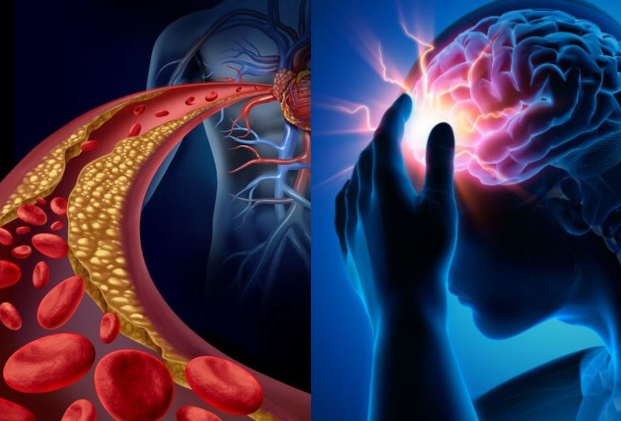 Τριγλυκερίδια: Πως να τα μειώσετε χωρίς φάρμακα