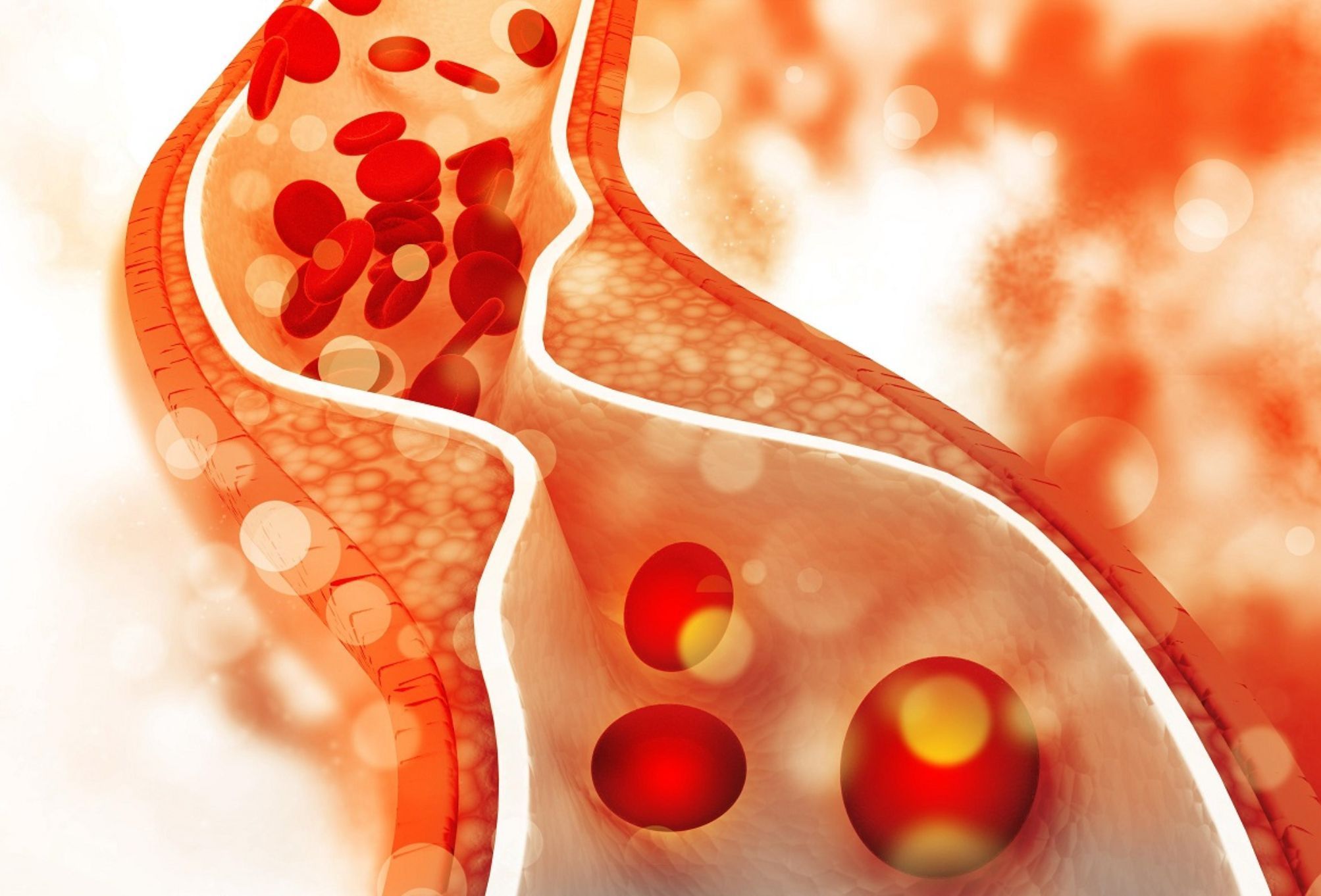 Τριγλυκερίδια: Πως να τα μειώσετε χωρίς φάρμακα