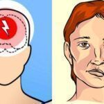 Εγκεφαλικό: Αν έχεις αυτή την ομάδα αίματος έχεις  αυξημένη πιθανότητα επεισοδίου