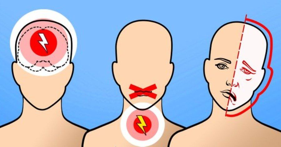 Εγκεφαλικό: Αν έχεις αυτή την ομάδα αίματος έχεις αυξημένη πιθανότητα επεισοδίου