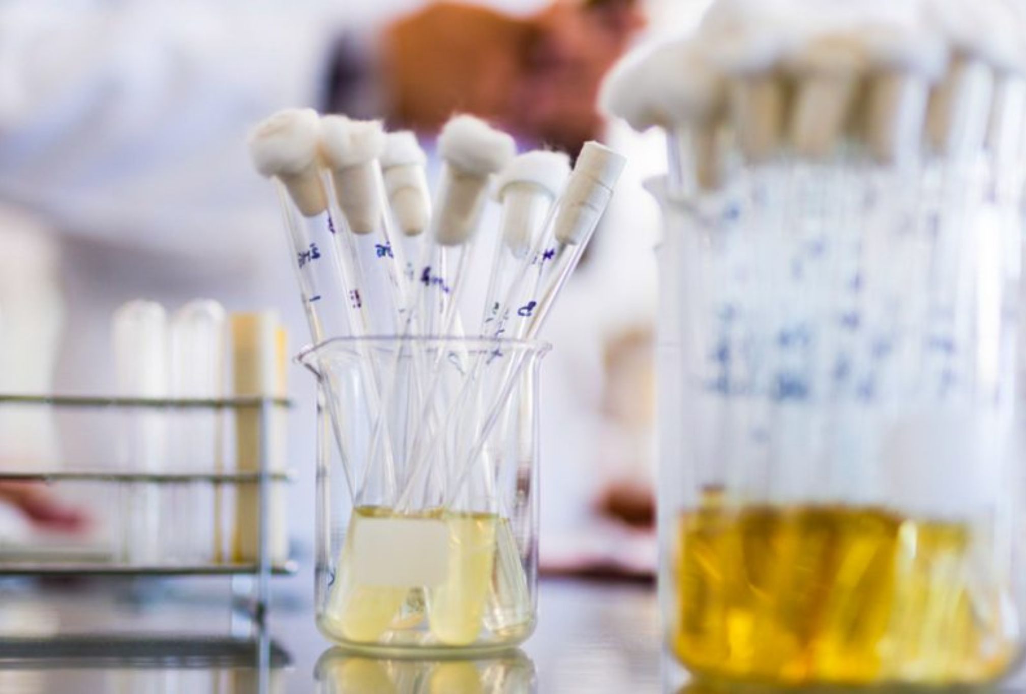 Βλέννη στα ούρα: Αιτίες συμπτώματα διάγνωση και θεραπεία