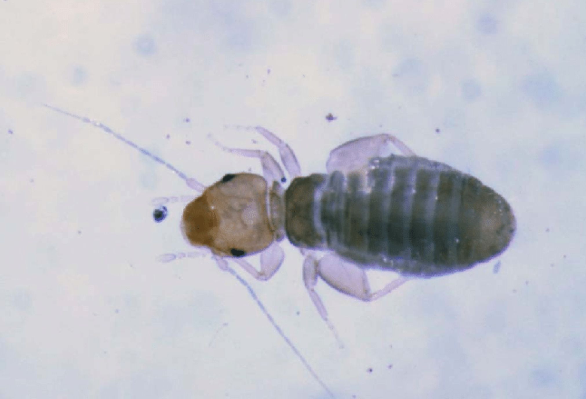 Μικροσκοπικά μαύρα έντομα στα ντουλάπια την βιβλιοθήκη και τα ρούχα: Δείτε πως να τα διώξετε μια και καλή